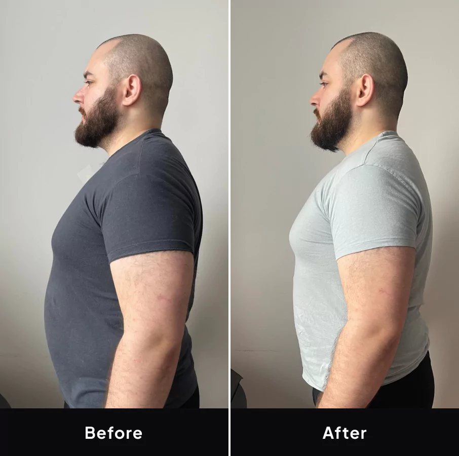 Mark before and after image