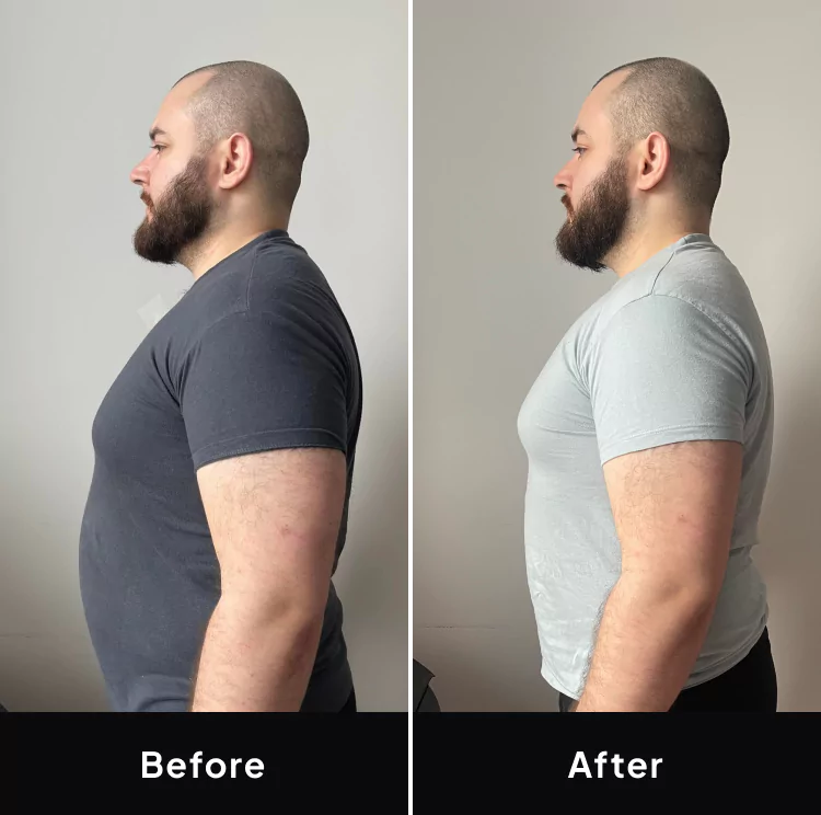 Mark before and after image