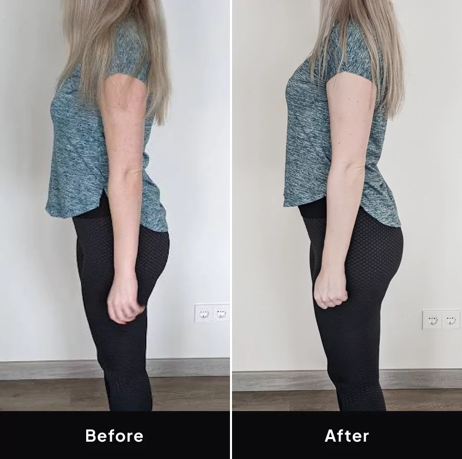 Roberta before and after image